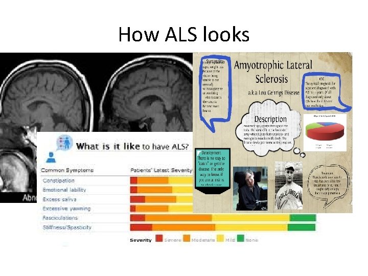 How ALS looks 
