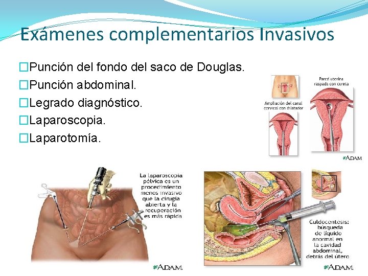 Exámenes complementarios Invasivos �Punción del fondo del saco de Douglas. �Punción abdominal. �Legrado diagnóstico.