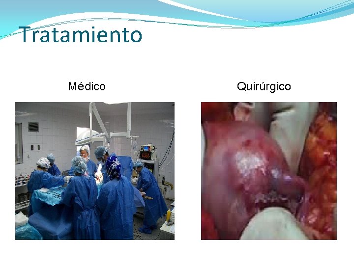 Tratamiento Médico Quirúrgico 