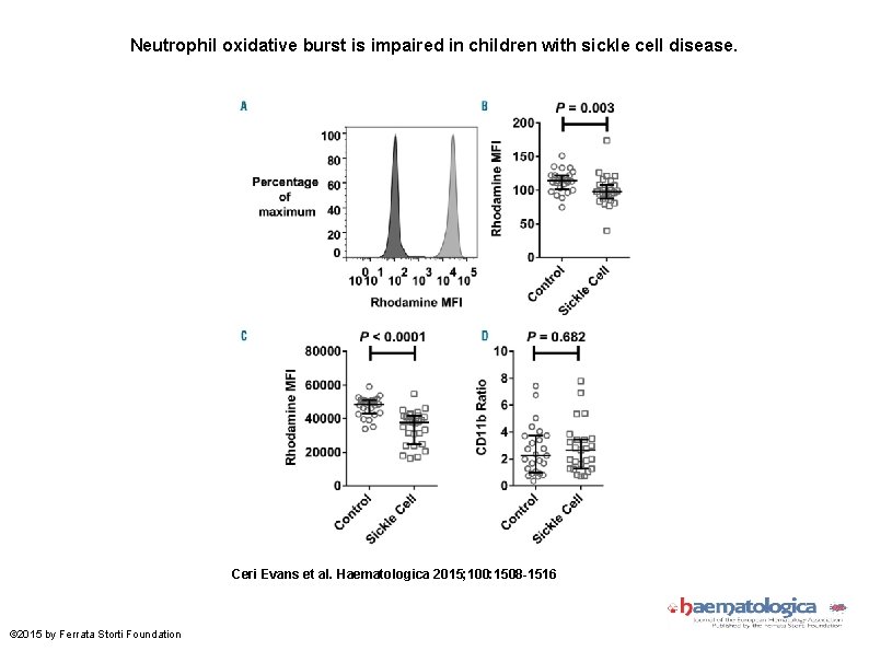 Neutrophil oxidative burst is impaired in children with sickle cell disease. Ceri Evans et