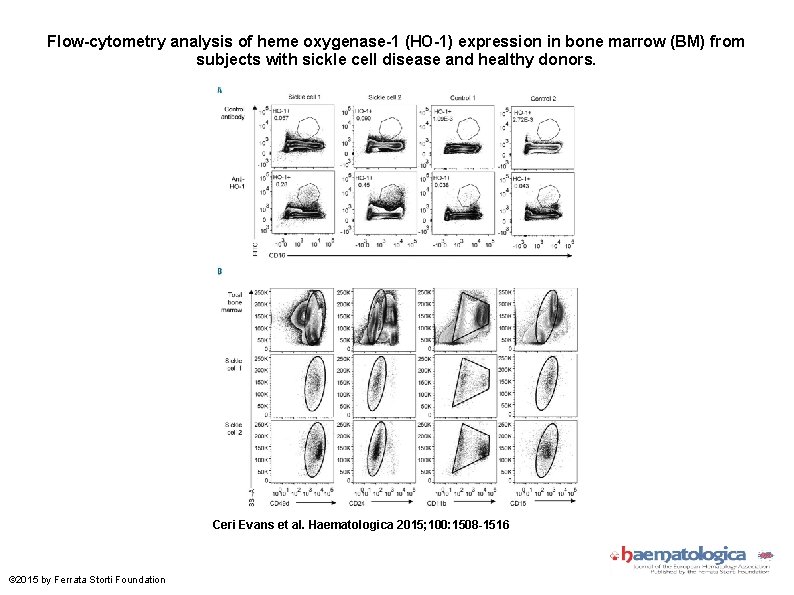 Flow-cytometry analysis of heme oxygenase-1 (HO-1) expression in bone marrow (BM) from subjects with