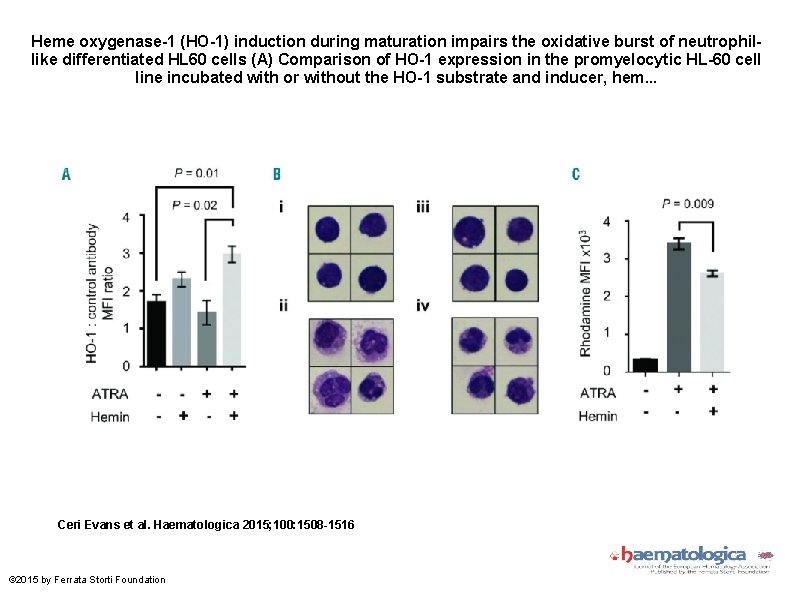 Heme oxygenase-1 (HO-1) induction during maturation impairs the oxidative burst of neutrophillike differentiated HL