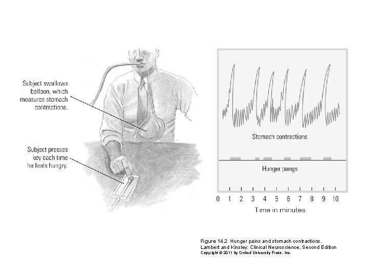 Figure 14. 2 Hunger pains and stomach contractions. Lambert and Kinsley: Clinical Neuroscience, Second
