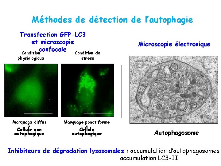 Méthodes de détection de l’autophagie Transfection GFP-LC 3 et microscopie confocale Condition physiologique Marquage