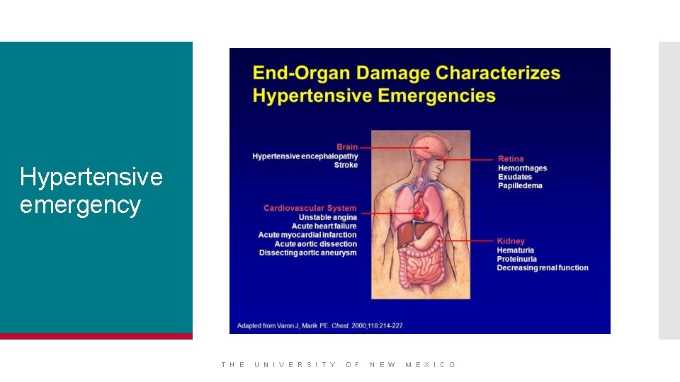 Hypertensive emergency T H E U N I V E R S I T