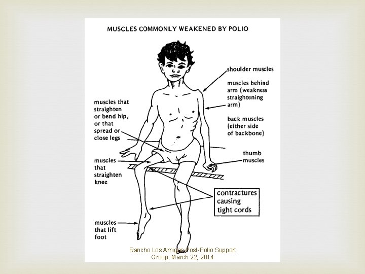 Rancho Los Amigos Post-Polio Support Group, March 22, 2014 