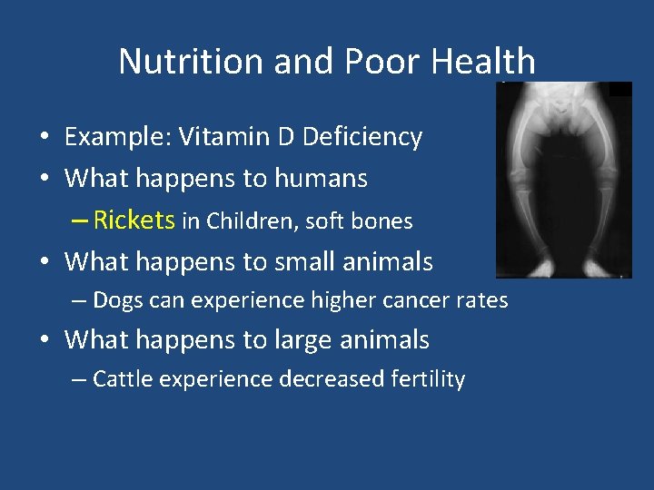 Nutrition and Poor Health • Example: Vitamin D Deficiency • What happens to humans