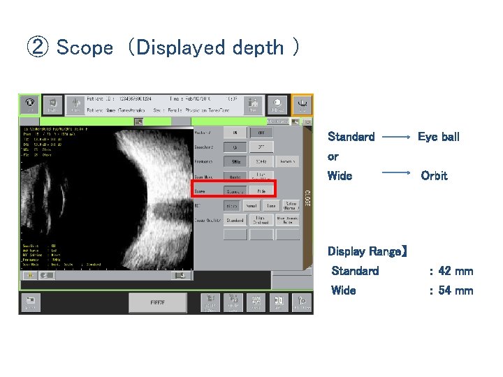 ② Scope（Displayed depth ） Standard Eye ball or Wide Orbit Display Range】 Standard ：