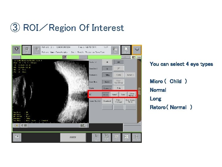 ③ ROI／Region Of Interest You can select 4 eye types Micro ( Child )