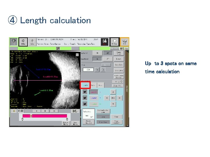 ④ Length calculation Up to 3 spots on same time calculation 
