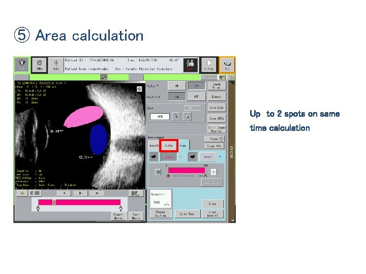 ⑤ Area calculation Up to 2 spots on same time calculation 