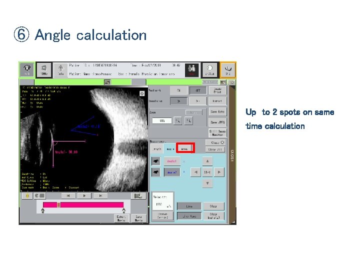 ⑥ Angle calculation Up to 2 spots on same time calculation 