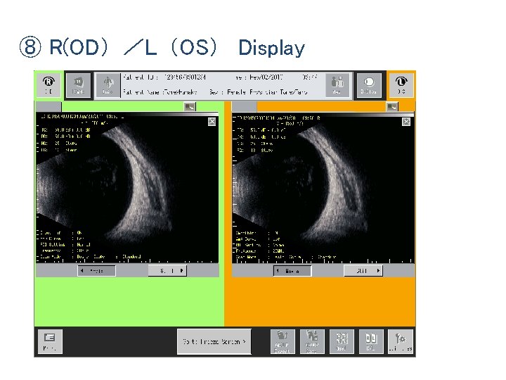 ⑧ R(OD）／L（OS） Display 