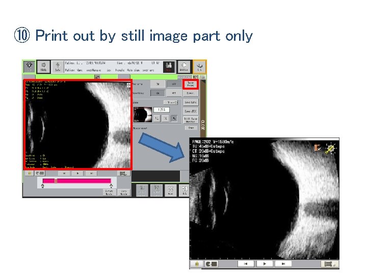 ⑩ Print out by still image part only 