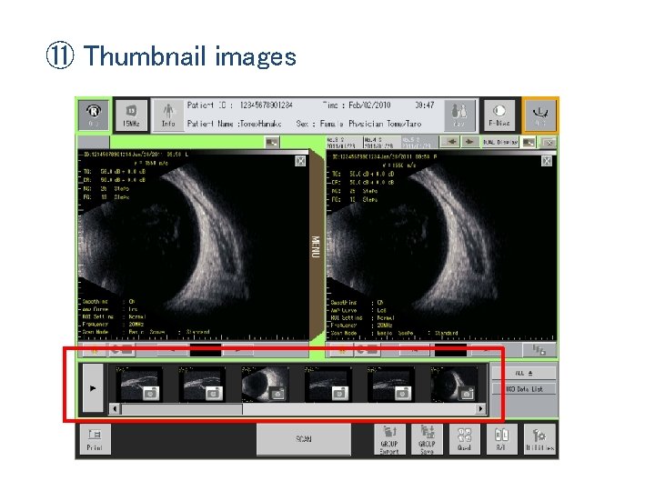 ⑪ Thumbnail images 