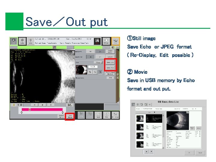 Save／Out put ①Still image Save Echo or JPEG format ( Re-Display, Edit possible )