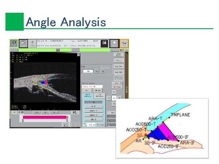 Angle Analysis 