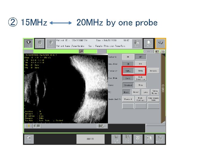 ② 15 MHz 20 MHz by one probe 