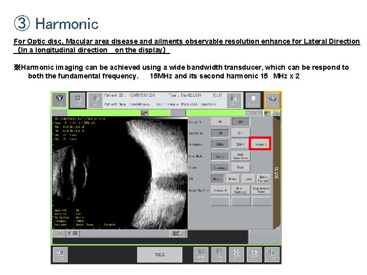 ③ Harmonic For Optic disc, Macular area disease and ailments observable resolution enhance for