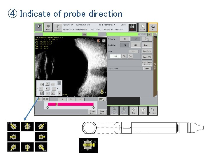 ④ Indicate of probe direction 