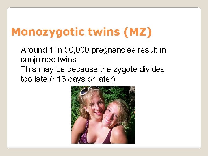 Monozygotic twins (MZ) Around 1 in 50, 000 pregnancies result in conjoined twins This