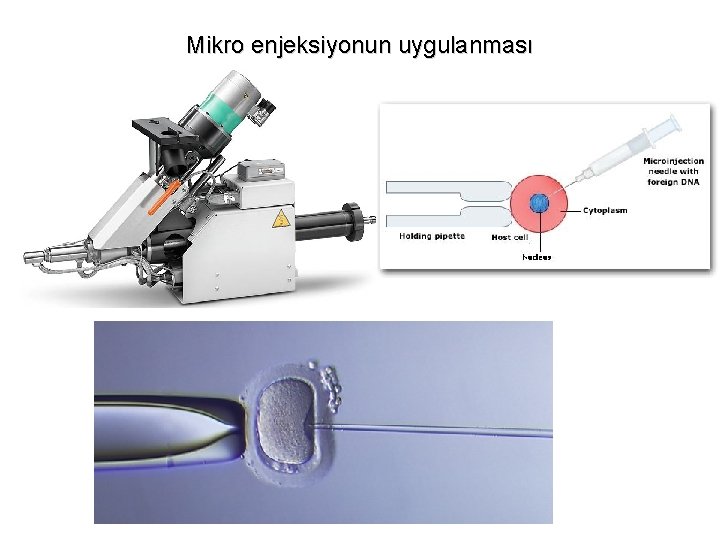 Mikro enjeksiyonun uygulanması 