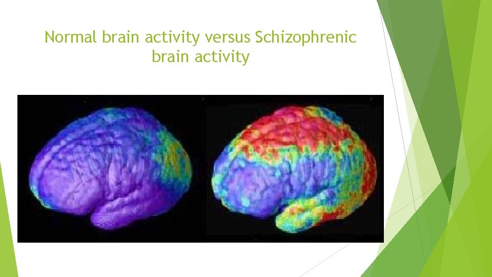 Normal brain activity versus Schizophrenic brain activity 