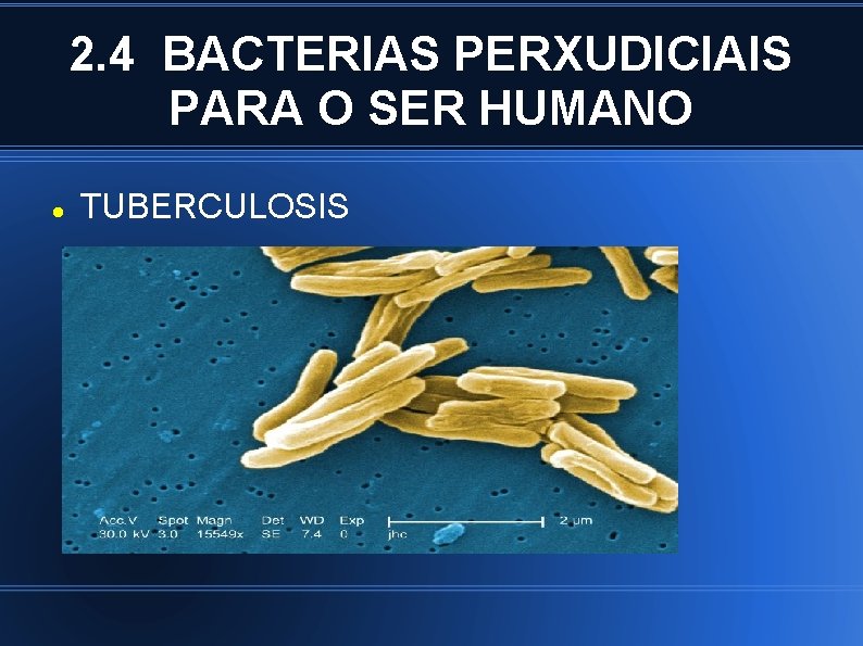 2. 4 BACTERIAS PERXUDICIAIS PARA O SER HUMANO TUBERCULOSIS 