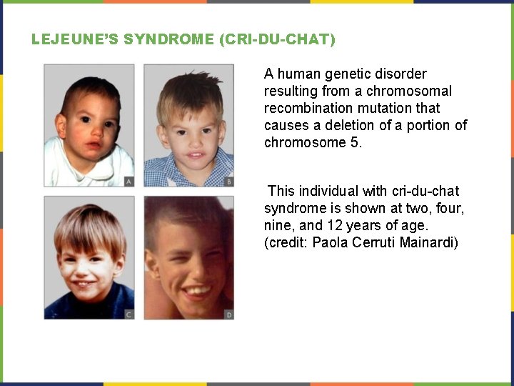 LEJEUNE’S SYNDROME (CRI-DU-CHAT) A human genetic disorder resulting from a chromosomal recombination mutation that