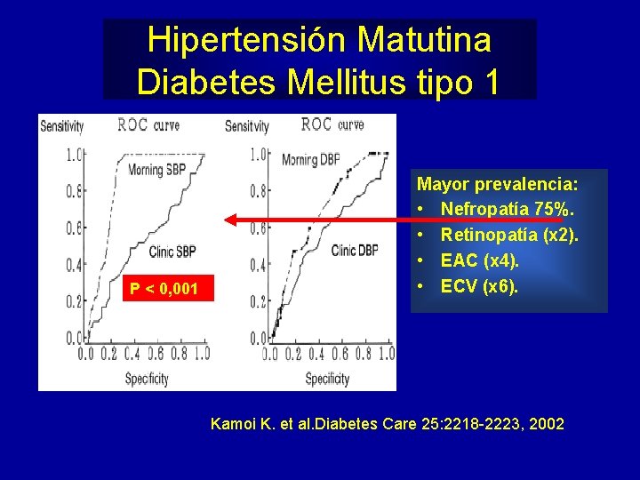 Hipertensión Matutina Diabetes Mellitus tipo 1 P < 0, 001 Mayor prevalencia: • Nefropatía
