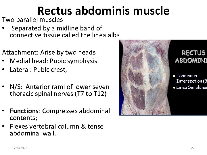 Rectus abdominis muscle Two parallel muscles • Separated by a midline band of connective