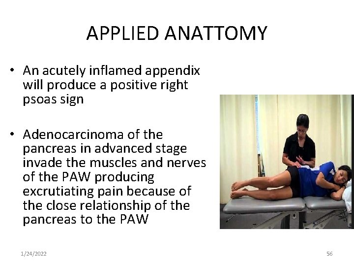 APPLIED ANATTOMY • An acutely inflamed appendix will produce a positive right psoas sign