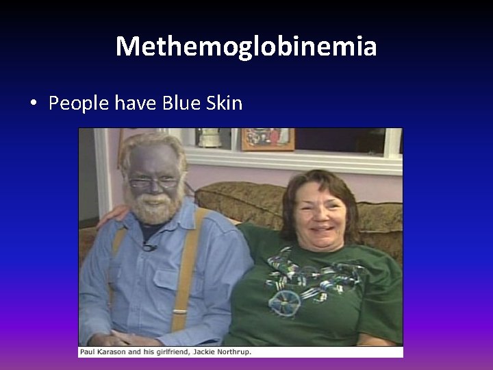 Methemoglobinemia • People have Blue Skin 