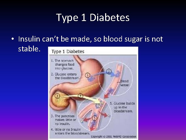 Type 1 Diabetes • Insulin can’t be made, so blood sugar is not stable.
