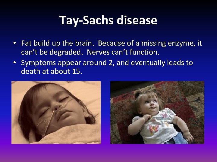 Tay-Sachs disease • Fat build up the brain. Because of a missing enzyme, it