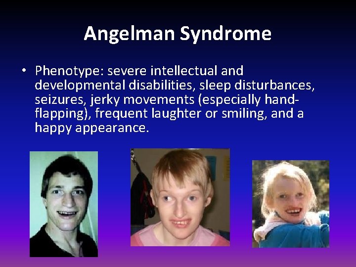 Angelman Syndrome • Phenotype: severe intellectual and developmental disabilities, sleep disturbances, seizures, jerky movements