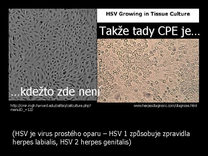 Takže tady CPE je… …kdežto zde není http: //cmir. mgh. harvard. edu/cellbio/cellculture. php? menu.