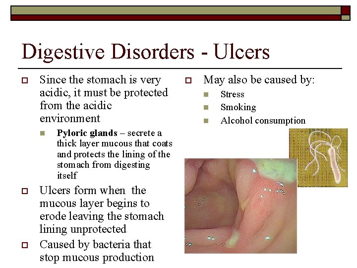 Digestive Disorders - Ulcers o Since the stomach is very acidic, it must be