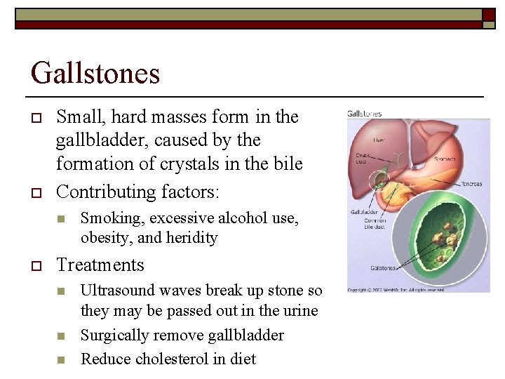 Gallstones o o Small, hard masses form in the gallbladder, caused by the formation