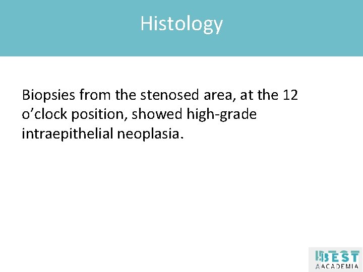 Histology Klik om de stijl te bewerken Biopsies from the stenosed area, at the