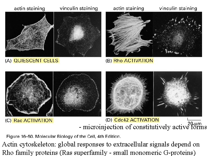 - microinjection of constitutively active forms Actin cytoskeleton: global responses to extracellular signals depend