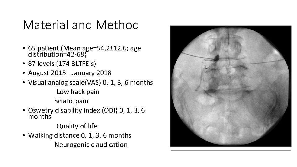 Material and Method • 65 patient (Mean age=54, 2± 12, 6; age distribution=42 -68)