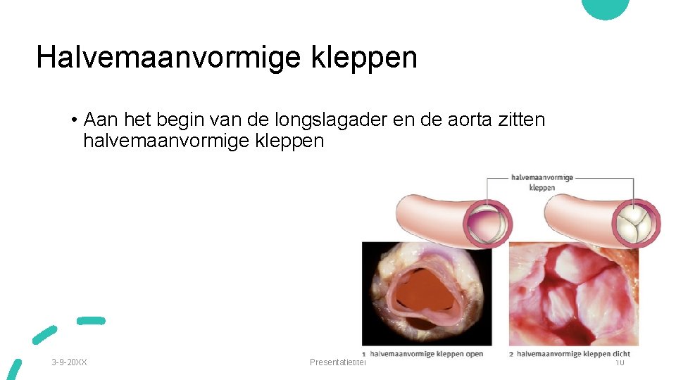 Halvemaanvormige kleppen • Aan het begin van de longslagader en de aorta zitten halvemaanvormige