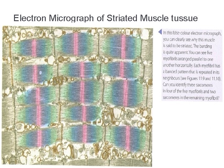 Electron Micrograph of Striated Muscle tussue 