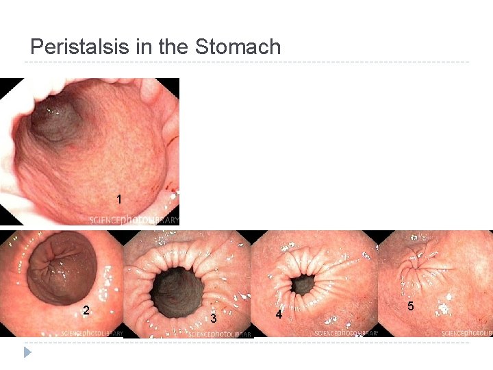 Peristalsis in the Stomach 1 2 3 4 5 