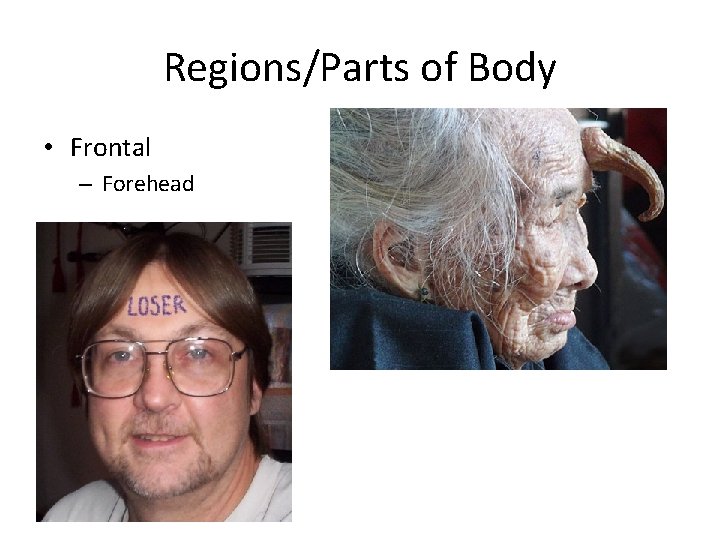 Regions/Parts of Body • Frontal – Forehead 