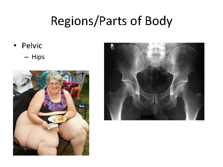 Regions/Parts of Body • Pelvic – Hips 