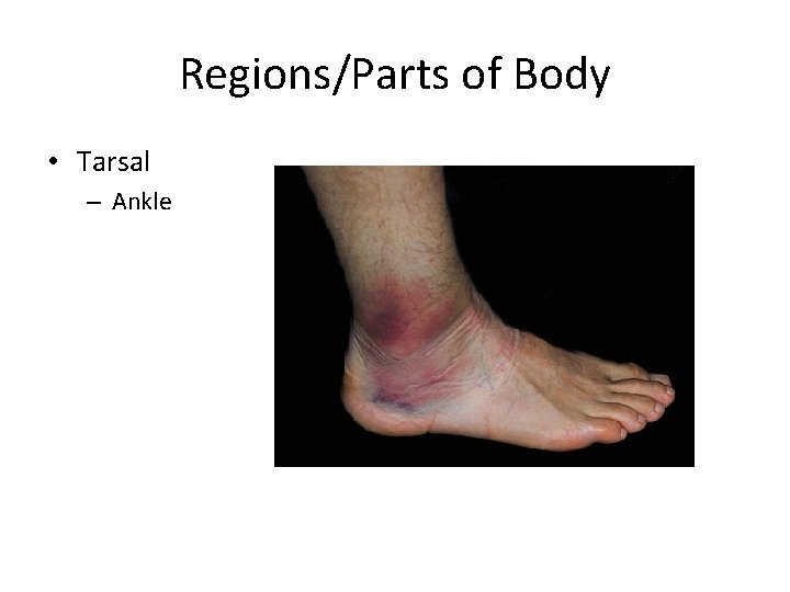 Regions/Parts of Body • Tarsal – Ankle 