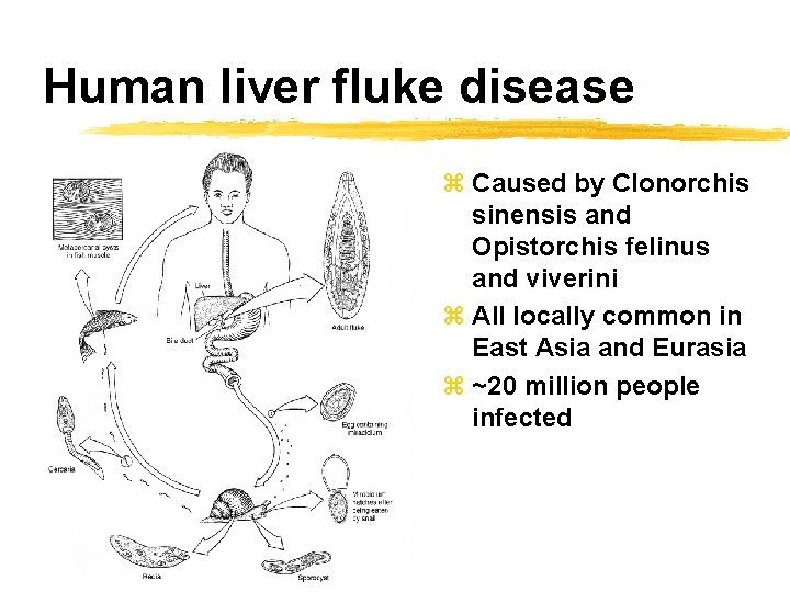 Human liver fluke disease z Caused by Clonorchis sinensis and Opistorchis felinus and viverini