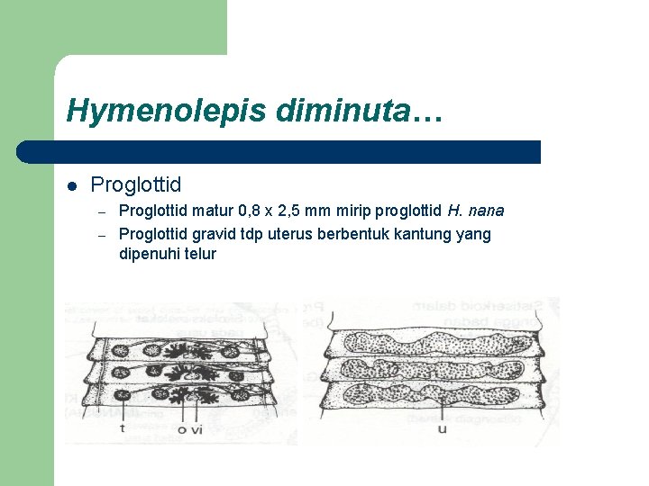 Hymenolepis diminuta… l Proglottid – – Proglottid matur 0, 8 x 2, 5 mm